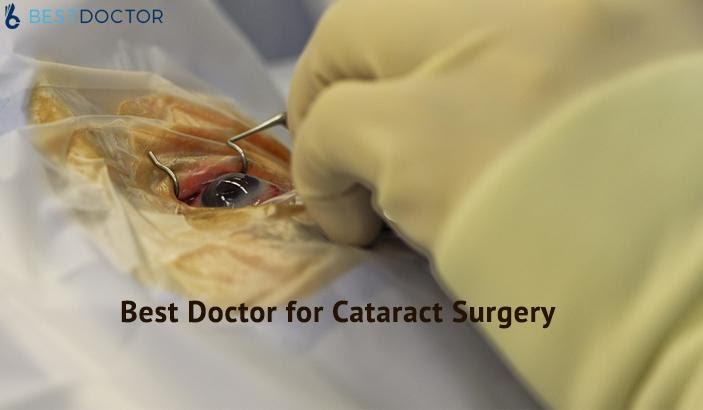 How to find best doctor for cataract surgery -ask a doctor online
